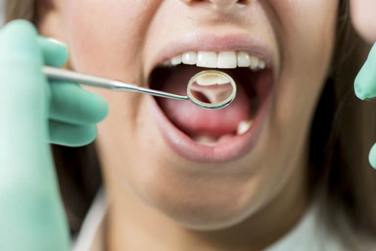 dental crowns bridges irvine